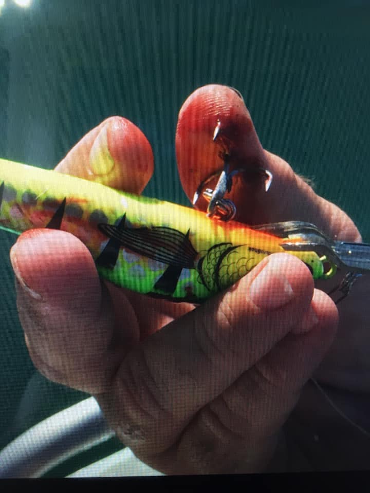 Fish hook accident - treble through the finger.